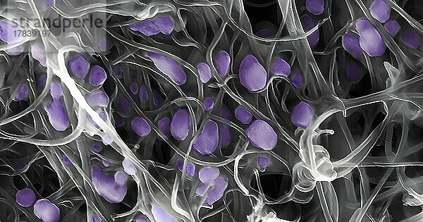 Die violetten Schoten  die Sie in dieser Rasterelektronenmikroskopaufnahme sehen  sind das Vogelgrippevirus H5N2  eine abgewendete Bedrohung für die Geflügel- und Eierindustrie und in sehr seltenen Fällen ein Risiko für die menschliche Gesundheit. Es ist jedoch unwahrscheinlich  dass diese speziellen Kapseln irgendetwas infizieren  da sie in einem grauen Netz aus Kohlenstoffnanoröhren gefangen sind. Diese Nanoröhren werden aus zylindrisch aufgehängten Kohlenstoffatomen hergestellt und sind etwa 10.000 Mal kleiner als die Breite eines menschlichen Haares.