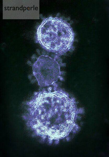 Kolorierte Transmissionselektronenmikroskopaufnahme  die Partikel des 2012 aufgetretenen Coronavirus des Middle East Respiratory Syndrome zeigt.