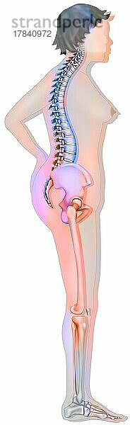 Knochensystem: Silhouette einer 60-jährigen Frau mit mittelschwerer Osteoporose.