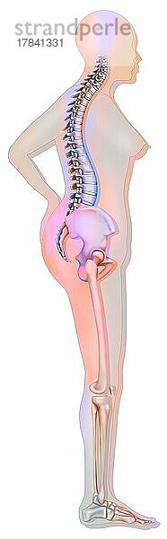 Knochensystem: Silhouette einer 60-jährigen Frau mit mittelschwerer Osteoporose.