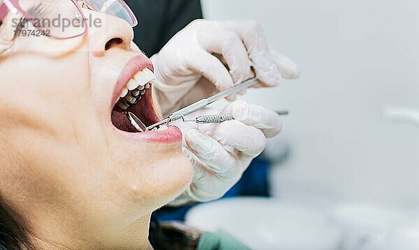Nahaufnahme eines Patienten  der vom Zahnarzt untersucht wird  Zahnarzt  der den Mund des Patienten untersucht  Nahaufnahme der Hände des Zahnarztes  Zahnarzt bei der Stomatologie