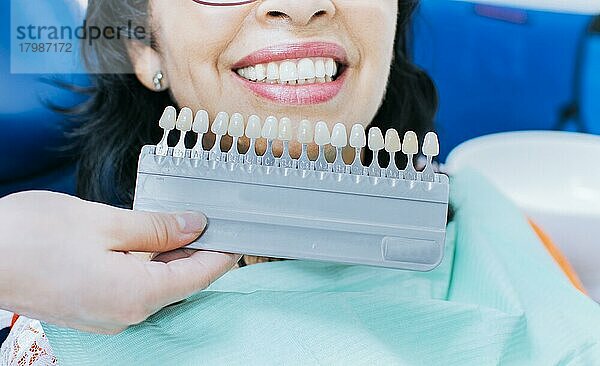 Kosmetische Zahnaufhellung in einer Zahnklinik  Auswahl des Farbtons des Implantatzahns  Frau hält ein Set von Implantaten mit verschiedenen Farbtönen  Lächelnde junge Frau