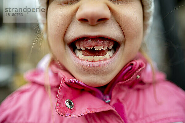 Glückliches Mädchen zeigt Zahnlücke