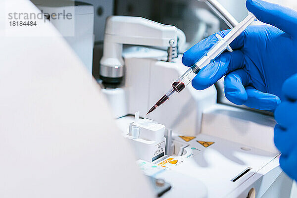 Hände eines jungen Arztes  der eine Blutprobe im Labor analysiert
