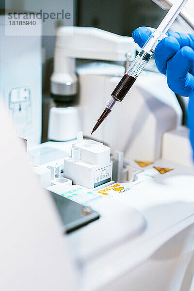 Hand eines Arztes  der eine Blutprobe im Labor analysiert