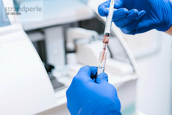 Hände eines Arztes  der eine Blutprobe im Labor analysiert