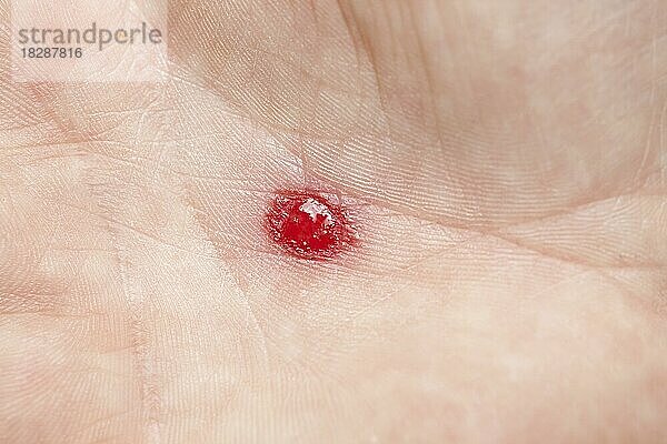 Blut auf einer Handfläche  Frauenhand
