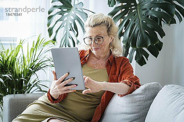 Lächelnde Frau mit Vitiligo-Haut sitzt mit Tablet-PC zu Hause auf dem Sofa