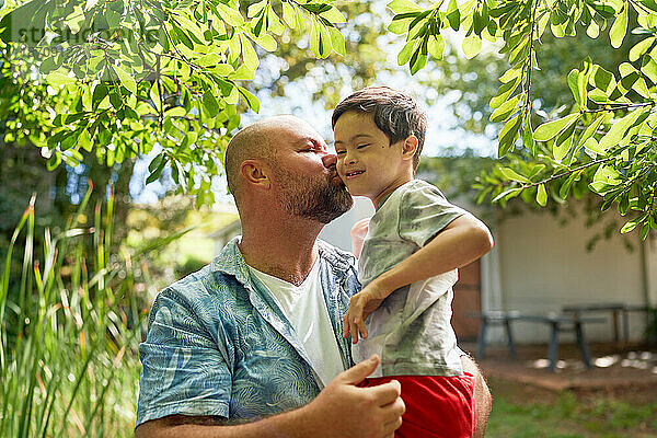 Vater küsst glücklichen  süßen Sohn mit Down-Syndrom im sommerlichen Hinterhof