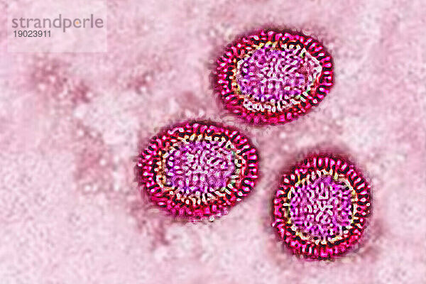Influenzavirus der Familie Orthomyxoviridae (respiratorische Virusinfektion). Transmissionselektronenmikroskopie  Virusdurchmesser 80 bis 120 Nanometer.