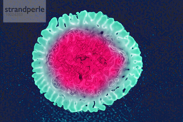 Influenzavirus der Familie Orthomyxoviridae (respiratorische Virusinfektion). Transmissionselektronenmikroskopie  Virusdurchmesser 80 bis 120 Nanometer.