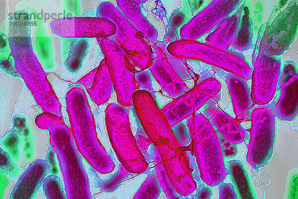 Escherichia coli (Darmbakterium  das im Verdauungstrakt von Menschen und Warmblütern vorkommt und eine Lebensmittelvergiftung verursacht. Elektronenmikroskopie.