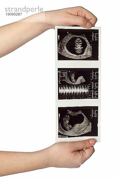 Hände halten Ultraschall Scans eines Babys vor weißem Hintergrund