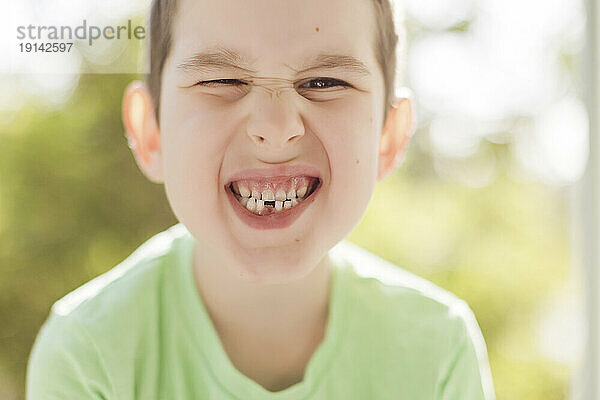 Netter Junge zeigt Zahnlücke