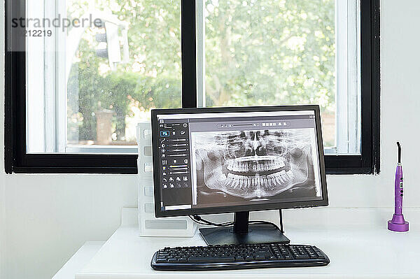 Röntgenaufnahme der Zähne am Computer am Schreibtisch in der Klinik