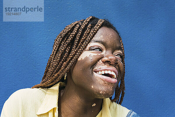 Glückliche Frau mit Vitiligo und geflochtenem Haar vor blauer Wand