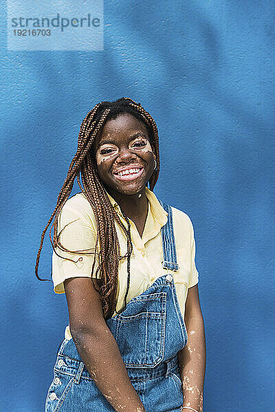 Glückliche junge Frau mit Vitiligo steht vor blauer Wand