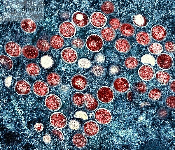 Kolorierte Transmissionselektronenmikroskopaufnahme von Affenpockenpartikeln (rot)  die in einer infizierten Zelle (blau) gefunden und im Labor kultiviert wurden.