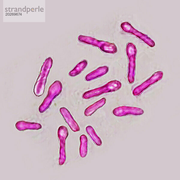 Clostridium botulinum-Bakterium (Botulismus-Bazillus). Dieses Bakterium sondert ein sehr starkes Toxin (Botox) ab  das die Motoneuronen der Muskelkontraktion hemmt. Bild aufgenommen mit einem optischen X-1000-Mikroskop.