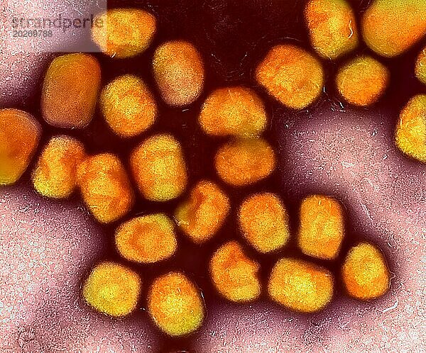 Kolorierte Transmissionselektronenmikroskopaufnahme von Affenpockenviruspartikeln (Gold)  die aus Zellkulturen kultiviert und gereinigt wurden.