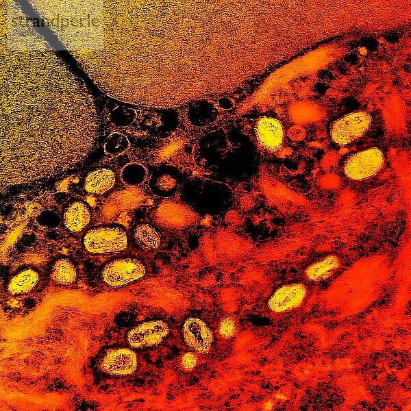 Kolorierte Transmissionselektronenmikroskopaufnahme von Affenpockenpartikeln (gelb)  die in einer infizierten Zelle (rot) gefunden und im Labor kultiviert wurden.