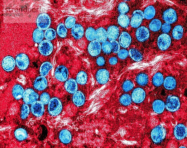 Kolorierte Transmissionselektronenmikroskopaufnahme von Affenpockenviruspartikeln (blau)  die in einer infizierten Zelle (rot) gefunden und im Labor kultiviert wurden.