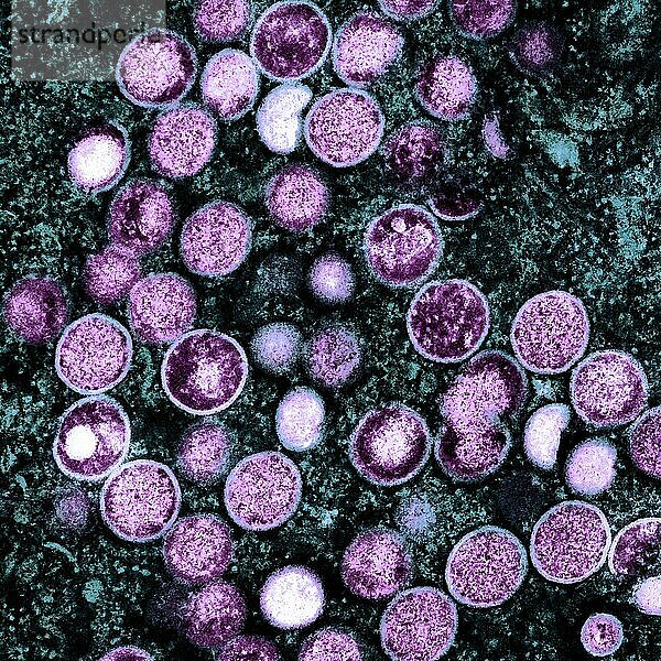 Kolorierte Transmissionselektronenmikroskopaufnahme von Affenpockenpartikeln (lila)  die in einer infizierten Zelle (blaugrün) gefunden und im Labor kultiviert wurden.