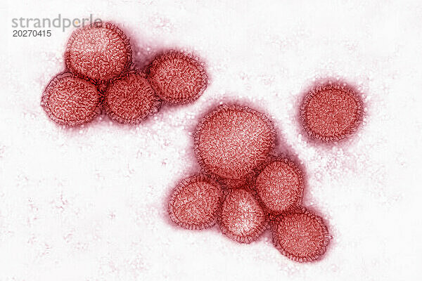 Coronavirus (CoV). Viren der Familie Coronaviridae und der Unterfamilie Orthocoronavirinae. Es ist ein Erreger respiratorischer Syndrome. Aus einem Transmissionselektronenmikroskop-Bild (TEM) betrachtet. Virusdurchmesser 80 nm bis 100 nm.