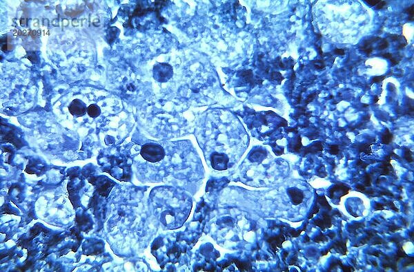 Unter 900-facher Vergrößerung zeigte diese Mikrofotografie das Vorhandensein einer Reihe von Trophozoiten des parasitären Organismus Entamoeba histolytica  Stamm J93  in dieser Gewebeprobe  die einer Ratte entnommen und mit der Färbemethode von Kohn präpariert wurde. CDC/Dr. Healy 1964