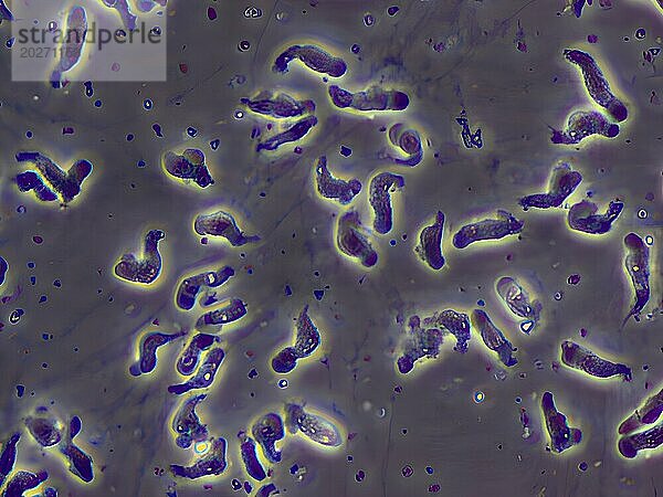 Eine feuchte Ansammlung von Naegleria fowleri-Trophozoiten  kultiviert aus der Liquor cerebrospinalis eines Patienten mit primärer amöbenischer Meningoenzephalitis  beobachtet durch Phasenkontrastmikroskopie. Vergrößerung: 600x