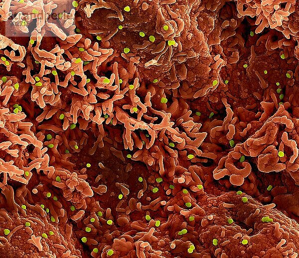 Kolorierte Rasterelektronenmikroskopaufnahme des Affenpockenvirus (grün) auf der Oberfläche infizierter VERO E6-Zellen (rot).