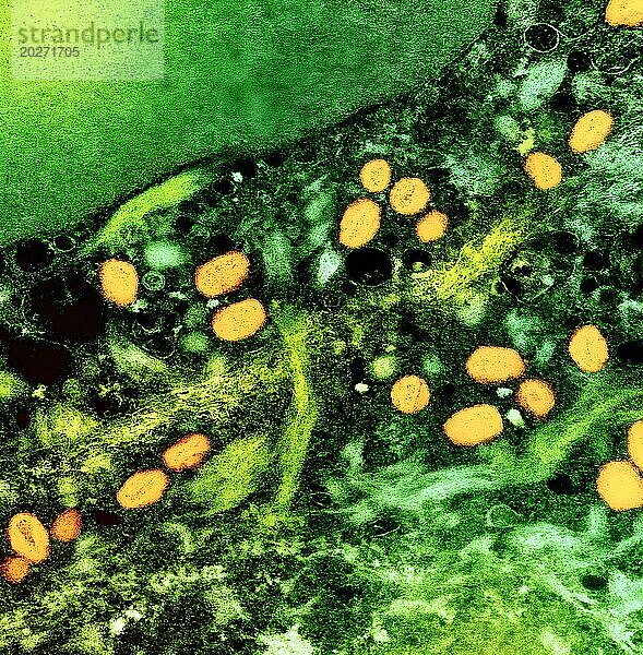 Kolorierte Transmissionselektronenmikroskopaufnahme von Affenpockenpartikeln (gelb)  die in einer infizierten Zelle (grün) gefunden und im Labor kultiviert wurden.