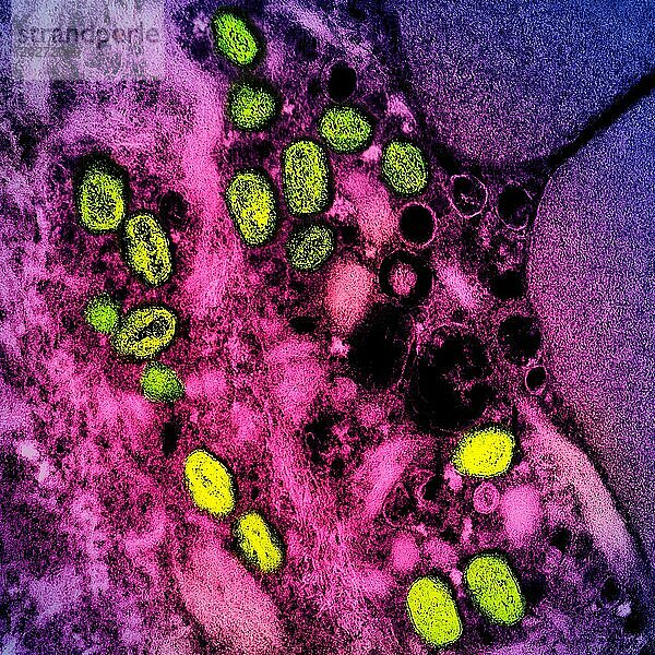 Kolorierte Transmissionselektronenmikroskopaufnahme von Affenpockenpartikeln (grün)  die in einer infizierten Zelle (rosa und lila) gefunden und im Labor kultiviert wurden.