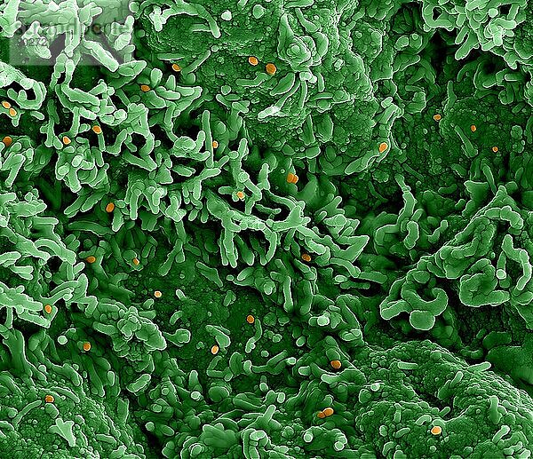 Kolorierte Rasterelektronenmikroskopaufnahme des Affenpockenvirus (orange) auf der Oberfläche infizierter VERO E6-Zellen (grün).