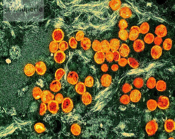 Kolorierte Transmissionselektronenmikroskopaufnahme von Affenpockenviruspartikeln (orange)  die in einer infizierten Zelle (grün) gefunden und im Labor kultiviert wurden.