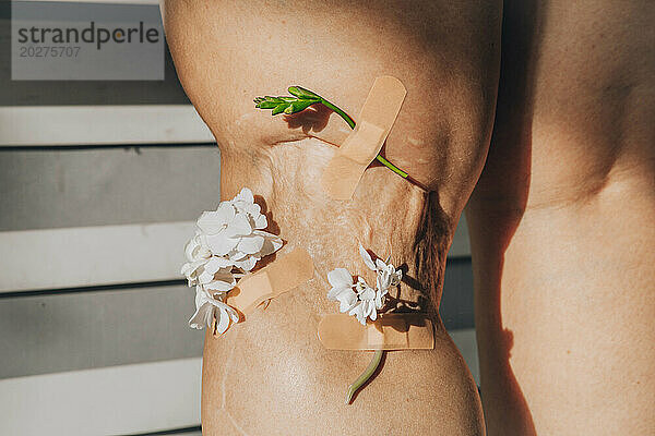 Mit Verband aufgeklebte Blumen auf Narbe am Bein einer Frau