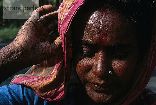 Arsenpatientin ist eine Frau namens Kamalamandal im Dorf Kandapkatti (Bezirk Mogra)  Westbengalen  Indien. Sie litt seit 11 oder 12 Jahren unter Arseneinwirkung. Sie fühlt sich brennend an