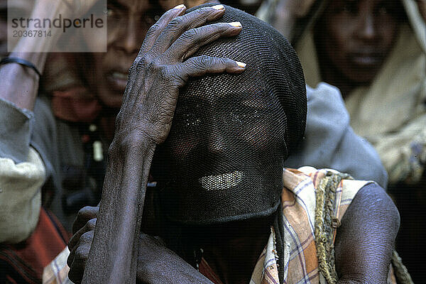 Eine unterernährte Frau mit einem Schleier über ihrem Gesicht  um ihre infizierten Augen zu schützen  wartet in Baidoa  Somalia  auf die Lebensmittelverteilung.