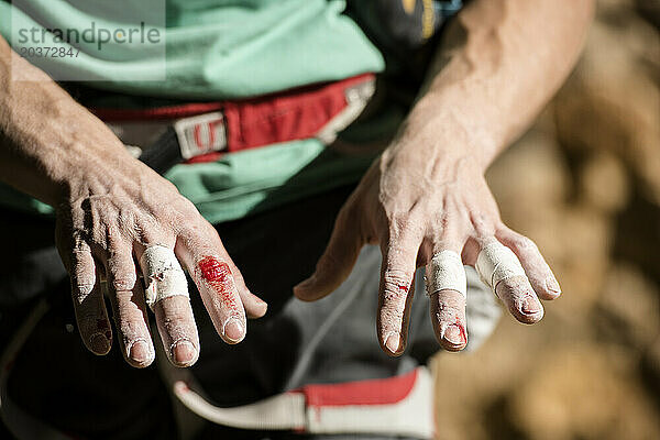 Stefano Ghisolfis Hände nach dem Senden von Demencia Senil  9a+ in Margalef  Spanien.