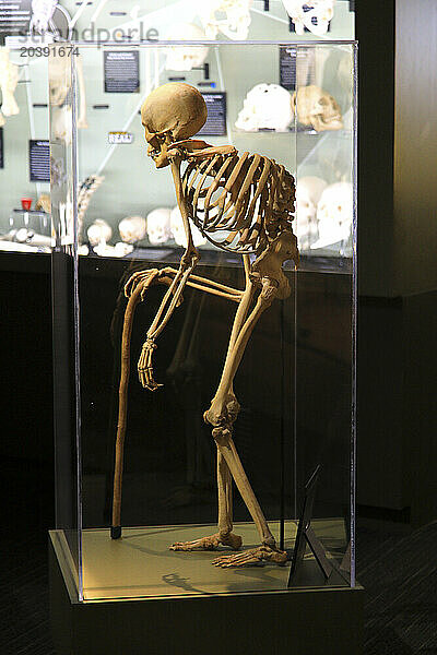 Usa  Floride  Orlando. SKELETONS: Museum Of Osteology. Old man