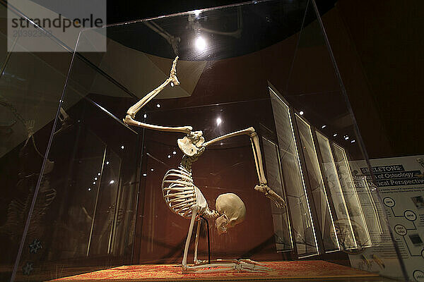 Usa  Floride  Orlando. SKELETONS: Museum Of Osteology. Gymnast skeleton