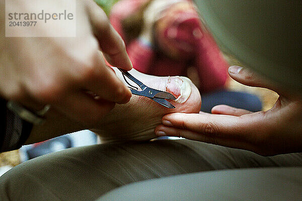 A hiker tends to another hikers severe blister.