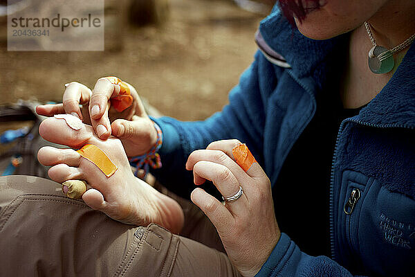 A hiker tends to an assorment of blisters and â€œhot spotâ€� on her feet.