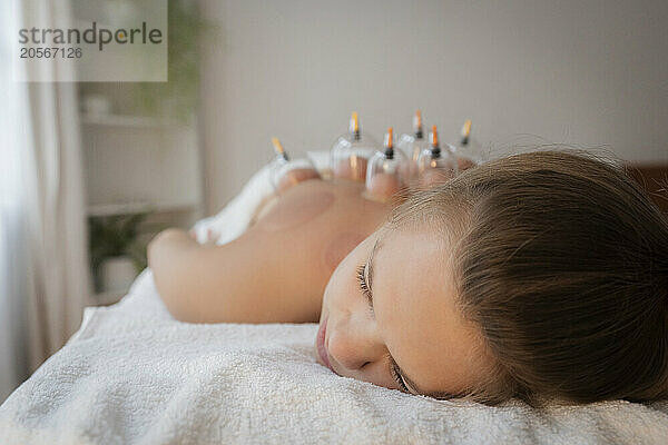 Teenage girl resting on massage table with vacuum cups on back