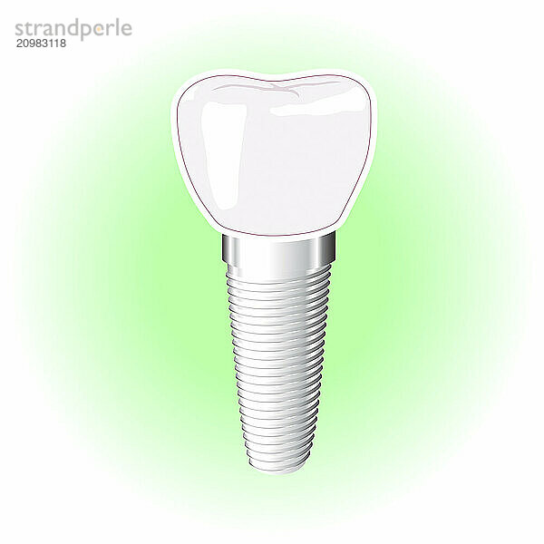 Dental implant vector illustration isolated on white green background