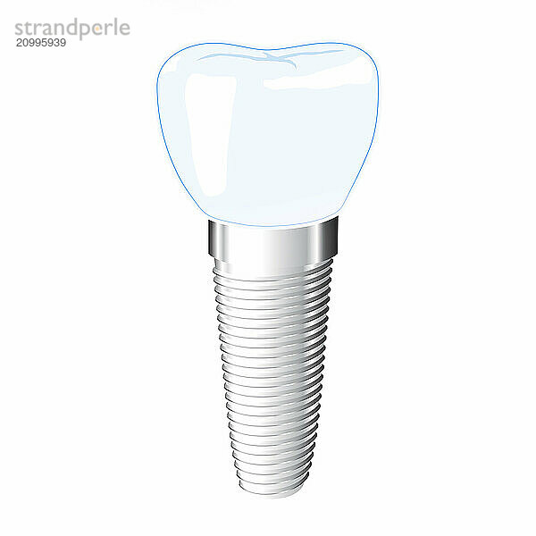 Dental implant vector illustration isolated on white background