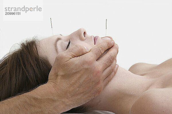 Set acupuncture needles in the facial area of a woman