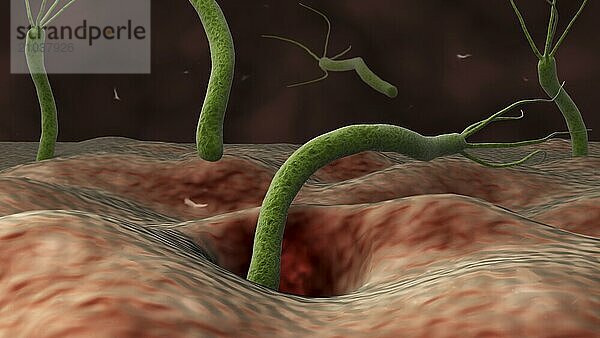 Conceptual image of helicobacter pylori bacteria entering the stomach