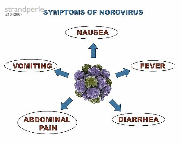 Medical diagram showing symptoms of the norovirus