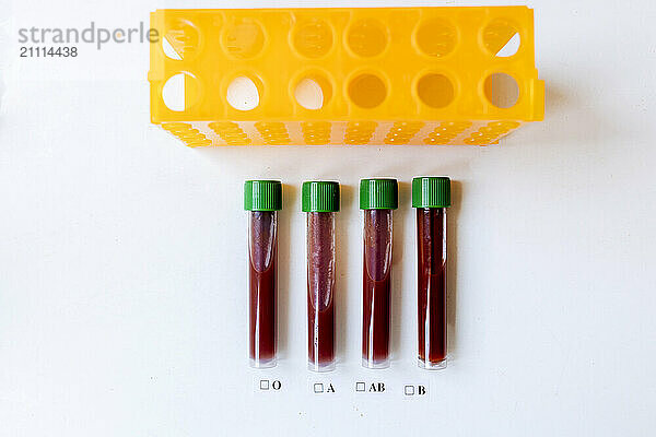 Blood test vials with green caps arranged next to blood type options.